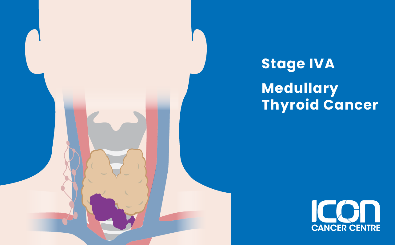 Stage IVA medullary thyroid cancer illustration